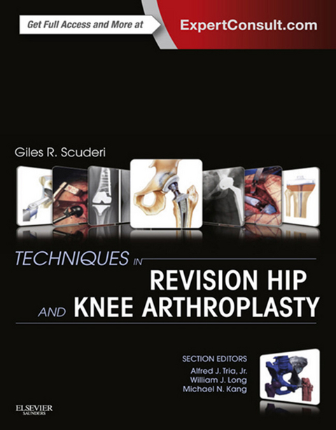 Techniques in Revision Hip and Knee Arthroplasty E-Book -  Giles R Scuderi