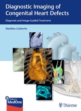 Diagnostic Imaging of Congenital Heart Defects - 