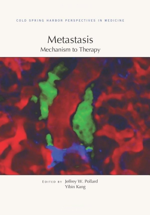 Metastasis: Mechanism to Therapy - 