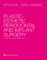 Plastic-esthetic Periodontal and Implant Surgery - Otto Zuhr