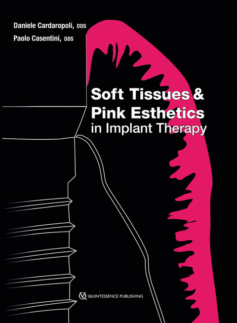 Soft Tissues & Pink Esthetics in Implant Therapy - Daniele Cardaropoli