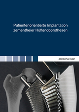 Patientenorientierte Implantation zementfreier Hüftendoprothesen - Johanna Bätz