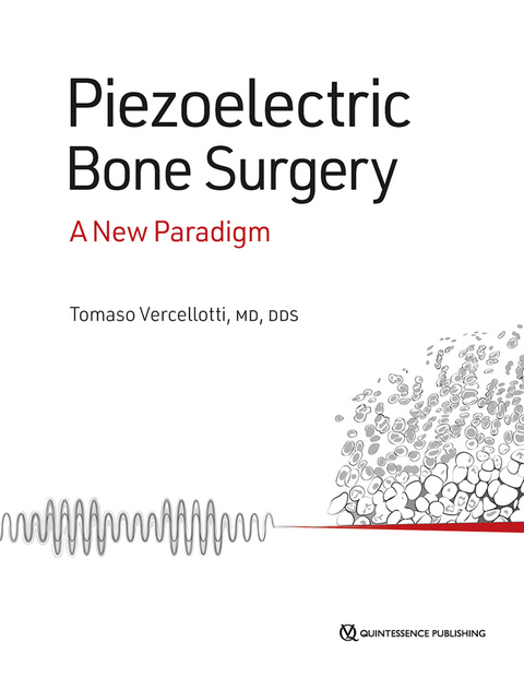 Piezoelectric Bone Surgery - Tomaso Vercellotti