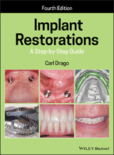 Implant Restorations - Drago, Carl