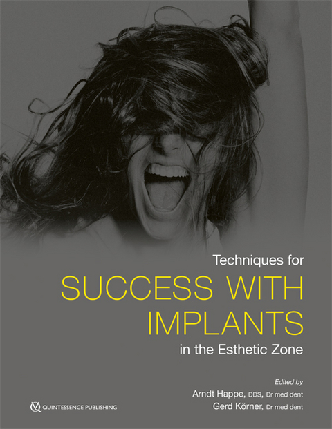 Techniques for Success with Implants in the Esthetic Zone - Arndt Happe