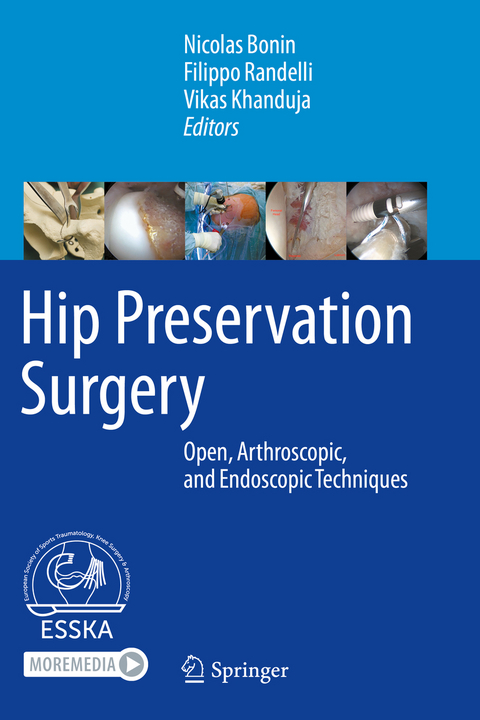 Hip Preservation Surgery - 