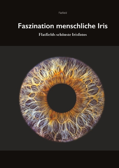 Fasziniation menschliche Iris - R.K. Flatfield