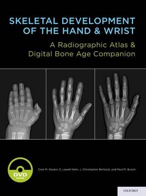 Skeletal Development of the Hand and Wrist -  J. Christoper Bertozzi,  Paul M. Bunch,  Cree M. Gaskin,  MD MBA S. Lowell Kahn