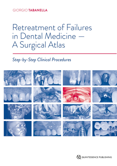 Retreatment of Failures in Dental Medicine -- A Surgical Atlas - Giorgio Tabanella