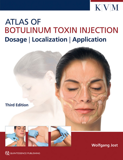 Atlas of Botulinum Toxin Injection -  Wolfgang Jost