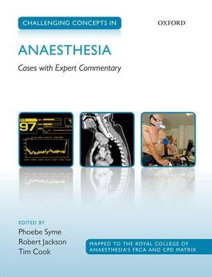 Challenging Concepts in Anaesthesia - 
