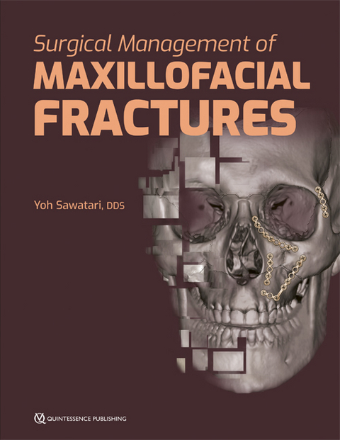 Surgical Management of Maxillofacial Fractures - Yoh Sawatari