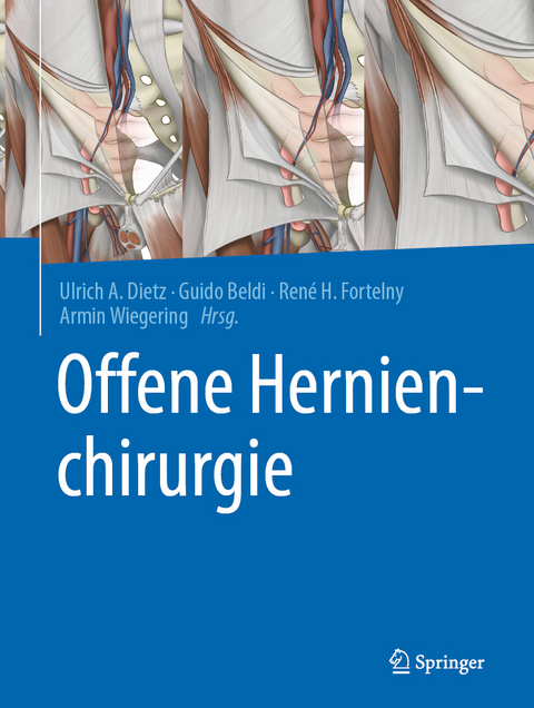 Offene Hernienchirurgie - 