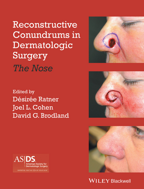 Reconstructive Conundrums in Dermatologic Surgery - 