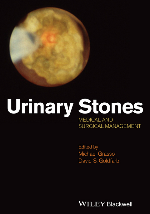 Urinary Stones - 
