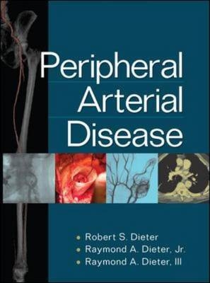 Peripheral Arterial Disease -  Raymond A. Dieter,  Robert S. Dieter