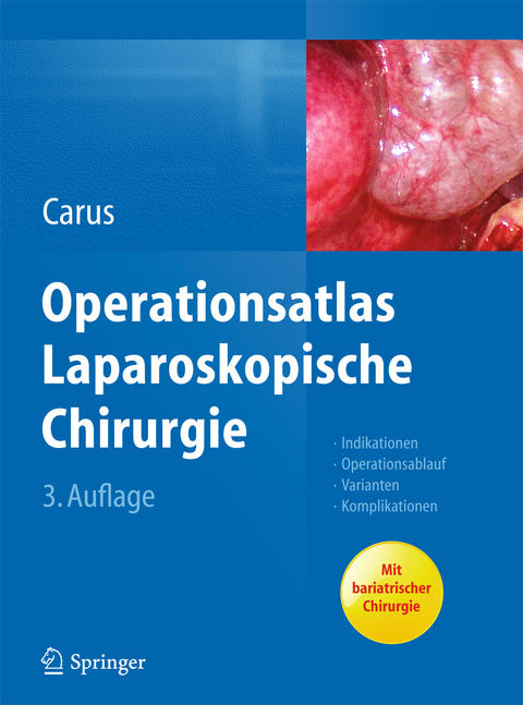 Operationsatlas Laparoskopische Chirurgie - Thomas Carus