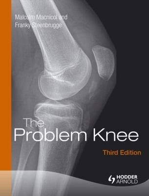 The Problem Knee -  Malcolm F. MacNicol, UK) Macnicol Malcolm (Edinburgh, Belgium) Steenbrugge Franky (Kerksken