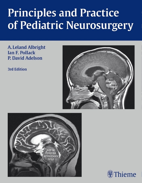 Principles and Practice of Pediatric Neurosurgery - A. Leland Albright, Ian F. Pollack, P. David Adelson