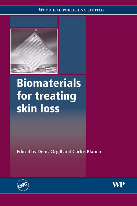 Biomaterials for Treating Skin Loss - 