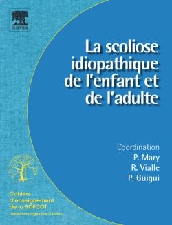 SCOLIOSE IDIOPATHIQUE DE ENFANT E -  MARY GUIGUI SOFCOT