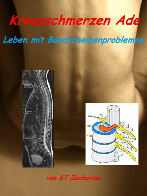 Kreuzschmerzen ade - ST Zacharias