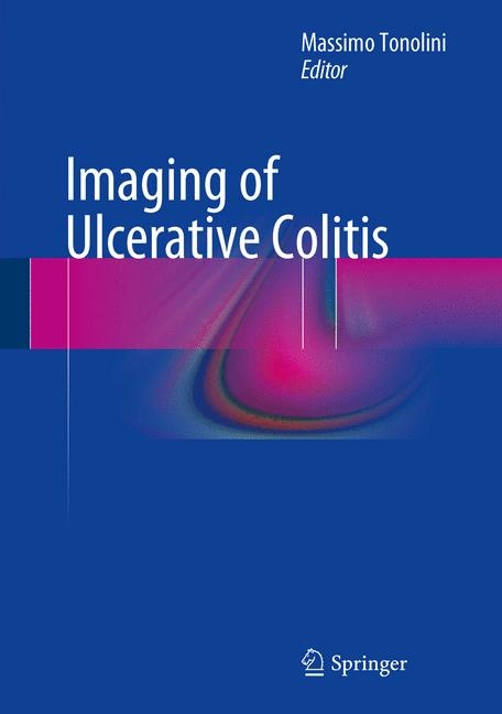 Imaging of Ulcerative Colitis - 
