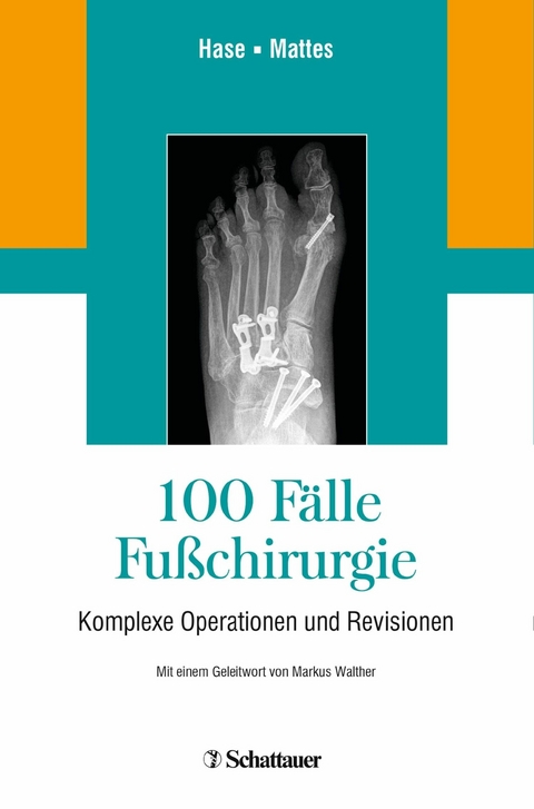 100 Fälle Fußchirurgie - 