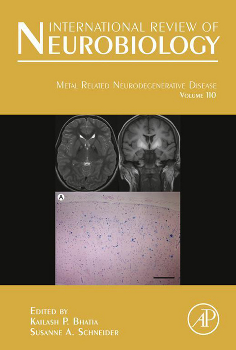 Metal Related Neurodegenerative Disease - 