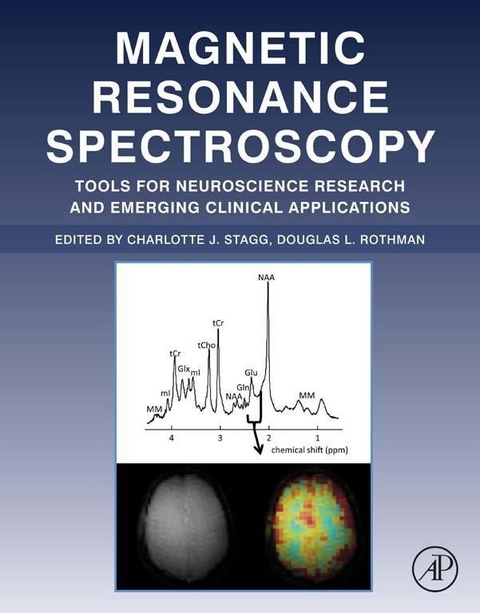 Magnetic Resonance Spectroscopy - 