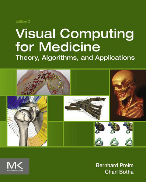 Visual Computing for Medicine -  Charl P Botha,  Bernhard Preim