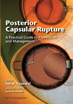 Posterior Capsular Rupture - 