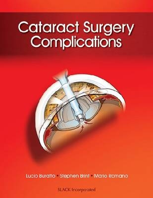 Cataract Surgery Complications - 