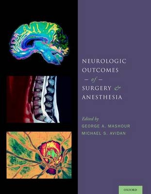Neurologic Outcomes of Surgery and Anesthesia - 