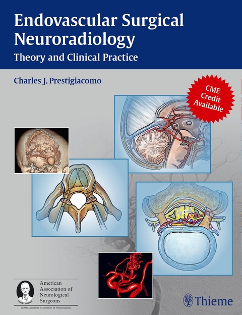 Endovascular Surgical Neuroradiology - 