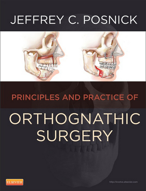 Orthognathic Surgery - E-Book -  Jeffrey C. Posnick