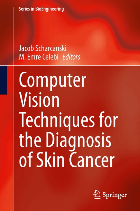 Computer Vision Techniques for the Diagnosis of Skin Cancer - 