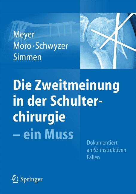 Die Zweitmeinung in der Schulterchirurgie - ein Muss -  Rainer Peter Meyer,  Fabrizio Moro,  Hans-Kaspar Schwyzer,  Beat Simmen
