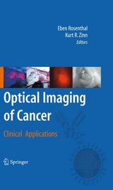 Optical Imaging of Cancer - 