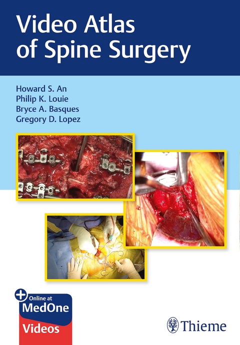Video Atlas of Spine Surgery - Howard An, Philip K. Louie, Bryce Basques, Gregory Lopez