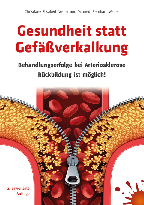 Gesundheit statt Gefäßverkalkung - Dr. med. Bernhard Weber, Christiane E. Weber