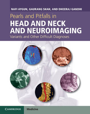 Pearls and Pitfalls in Head and Neck and Neuroimaging -  Nafi (The Johns Hopkins University) Aygun,  Dheeraj Gandhi,  Gaurang Shah