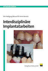 Interdisziplinäre Implantatarbeiten - Wolfgang Weisser, Armin Buresch