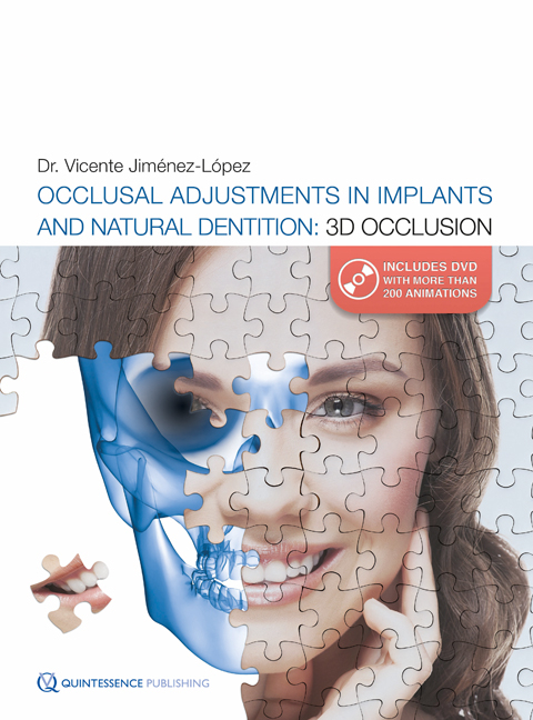 Occlusal Adjustments in Implants and Natural Dentition - Dr. Vicente Jimenez-Lopez
