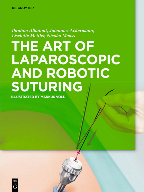 The Art of Laparoscopic and Robotic Suturing - M. A. Alkatout  Ibrahim, M. D. Ackermann  Johannes