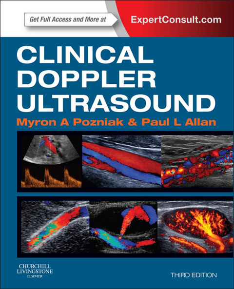 Clinical Doppler Ultrasound -  Paul L Allan,  Myron A. Pozniak