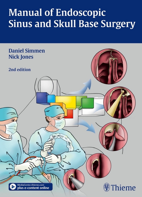 Manual of Endoscopic Sinus and Skull Base Surgery - 