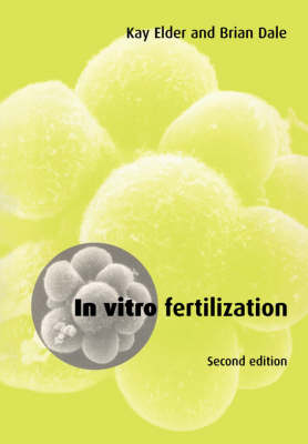 In Vitro Fertilization -  Brian Dale,  Kay Elder