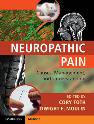 Neuropathic Pain - 