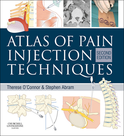 Atlas of Pain Injection Techniques -  Stephen E. Abram,  Therese C. O'Connor